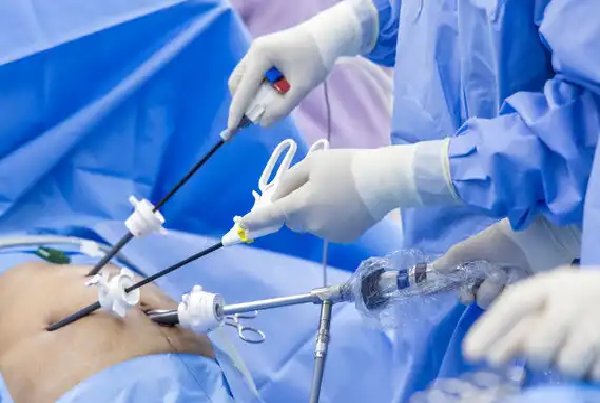 General Surgery including Laparoscopic Surgery