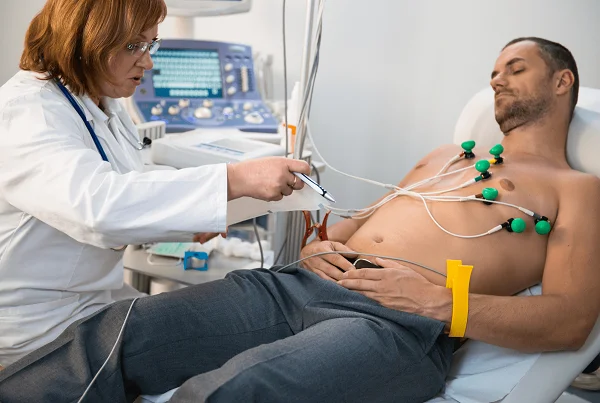 ECG